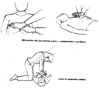 Cardiac resuscitation and Breathing